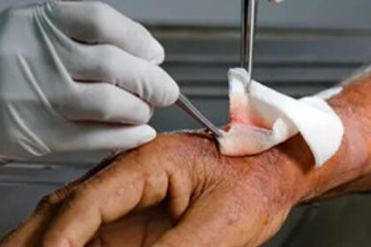 woundcare